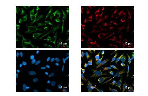 Immunocytochemistry/ Immunofluorescence - Anti-SDHA antibody [HL1117] (AB308379)