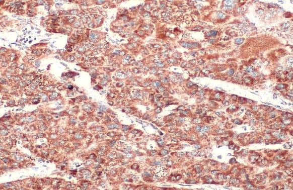 Immunohistochemistry paraffin embedded sections - Anti-SDHA antibody [HL1117] (AB308379), expandable thumbnail