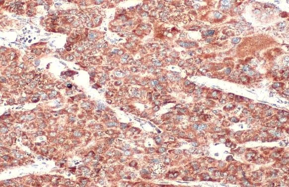 Immunohistochemistry paraffin embedded sections - Anti-SDHA antibody [HL1117] (AB308379)