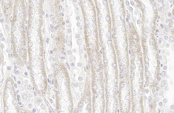 Immunohistochemistry paraffin embedded sections - Anti-SDHA antibody [HL1117] (ab308379), expandable thumbnail