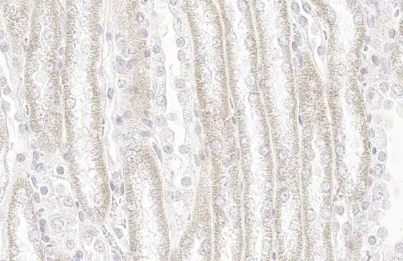 Immunohistochemistry paraffin embedded sections - Anti-SDHA antibody [HL1117] (AB308379)