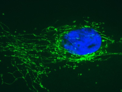 Immunocytochemistry/ Immunofluorescence - Anti-SDHB antibody [21A11AE7] (AB14714), expandable thumbnail