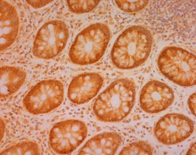 Immunohistochemistry (Frozen sections) - Anti-SDHB antibody [21A11AE7] (AB14714), expandable thumbnail