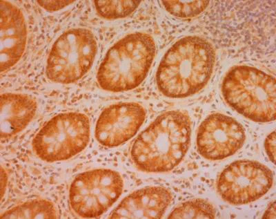 Immunohistochemistry (Frozen sections) - Anti-SDHB antibody [21A11AE7] (AB14714)