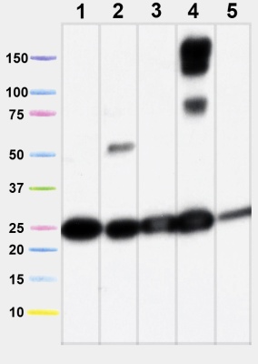 Western blot - Anti-SDHB antibody [21A11AE7] (AB14714), expandable thumbnail