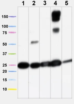 Western blot - Anti-SDHB antibody [21A11AE7] (AB14714)