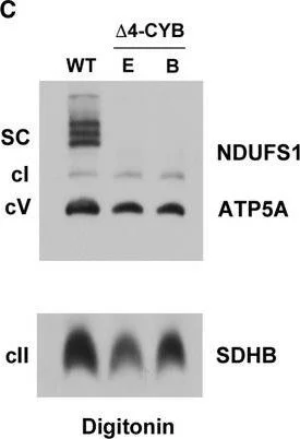 Western blot - Anti-SDHB antibody [21A11AE7] (AB14714)