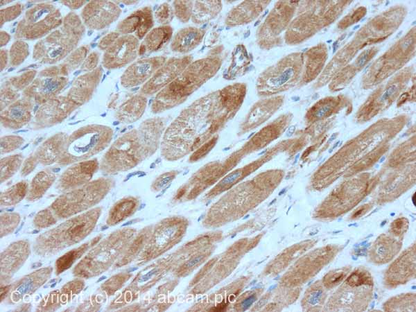 Immunohistochemistry (Formalin/PFA-fixed paraffin-embedded sections) - Anti-SDHB antibody (AB151684), expandable thumbnail