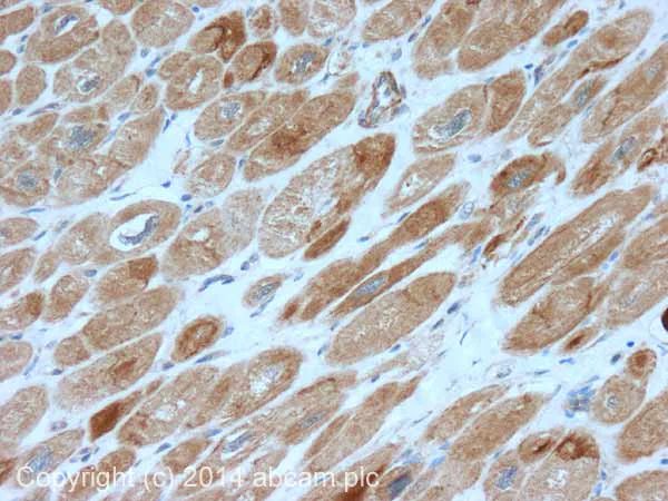 Immunohistochemistry (Formalin/PFA-fixed paraffin-embedded sections) - Anti-SDHB antibody (AB151684)