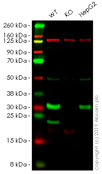 Western blot - Anti-SDHB antibody (AB151684)