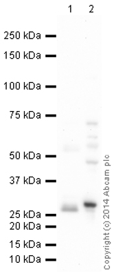 Western blot - Anti-SDHB antibody (AB151684), expandable thumbnail