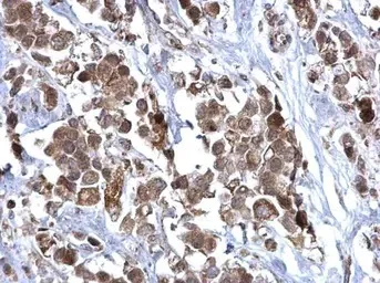 Immunohistochemistry (Formalin/PFA-fixed paraffin-embedded sections) - Anti-SDHB antibody (AB154974)