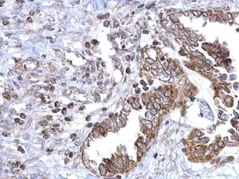 Immunohistochemistry (Formalin/PFA-fixed paraffin-embedded sections) - Anti-SDHB antibody (AB154974)
