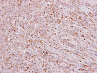 Immunohistochemistry (Formalin/PFA-fixed paraffin-embedded sections) - Anti-SDHB antibody (AB154974), expandable thumbnail