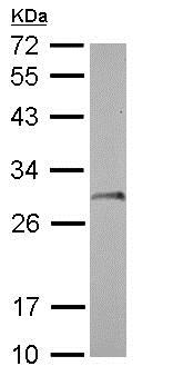 Western blot - Anti-SDHB antibody (AB154974), expandable thumbnail
