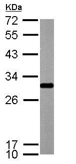 Western blot - Anti-SDHB antibody (AB154974), expandable thumbnail