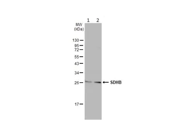 Western blot - Anti-SDHB antibody (AB154974)