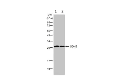 Western blot - Anti-SDHB antibody (AB154974)