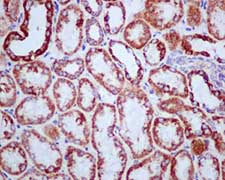 Immunohistochemistry (Formalin/PFA-fixed paraffin-embedded sections) - Anti-SDHB antibody [EPR10880] (ab175225), expandable thumbnail