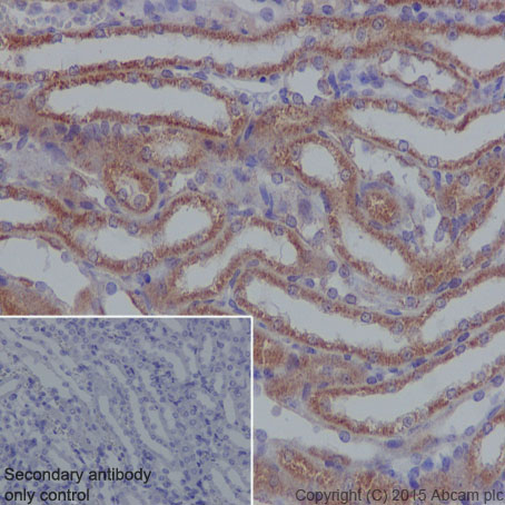 Immunohistochemistry (Formalin/PFA-fixed paraffin-embedded sections) - Anti-SDHB antibody [EPR10880] (ab175225), expandable thumbnail