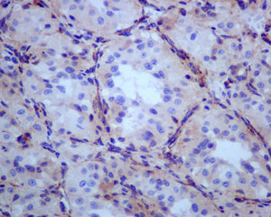 Immunohistochemistry (Formalin/PFA-fixed paraffin-embedded sections) - Anti-SDHB antibody [EPR10880] (ab175225), expandable thumbnail