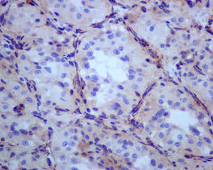Immunohistochemistry (Formalin/PFA-fixed paraffin-embedded sections) - Anti-SDHB antibody [EPR10880] (AB175225)