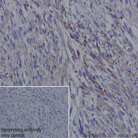Immunohistochemistry (Formalin/PFA-fixed paraffin-embedded sections) - Anti-SDHB antibody [EPR10880] (ab175225), expandable thumbnail