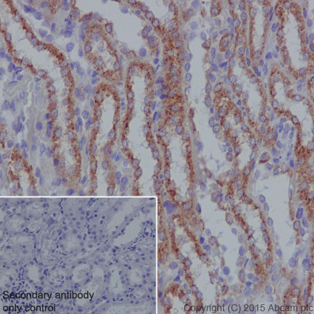 Immunohistochemistry (Formalin/PFA-fixed paraffin-embedded sections) - Anti-SDHB antibody [EPR10880] (ab175225), expandable thumbnail