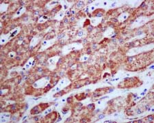 Immunohistochemistry (Formalin/PFA-fixed paraffin-embedded sections) - Anti-SDHB antibody [EPR10880] (AB175225), expandable thumbnail