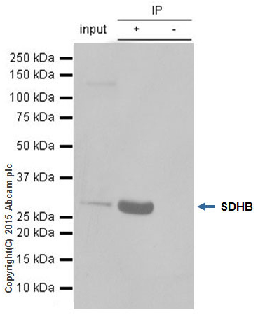 Immunoprecipitation - Anti-SDHB antibody [EPR10880] (ab175225), expandable thumbnail