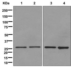 Western blot - Anti-SDHB antibody [EPR10880] (ab175225), expandable thumbnail