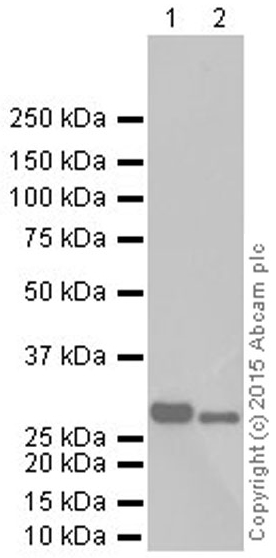 Western blot - Anti-SDHB antibody [EPR10880] (AB175225), expandable thumbnail