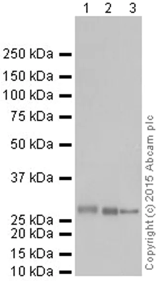 Western blot - Anti-SDHB antibody [EPR10880] (AB175225)