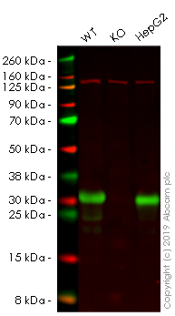 Western blot - Anti-SDHB antibody [EPR10880] (AB175225), expandable thumbnail