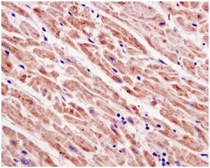Immunohistochemistry (Formalin/PFA-fixed paraffin-embedded sections) - Anti-SDHB antibody [EPR13042(B)] (AB178423), expandable thumbnail
