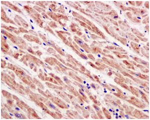 Immunohistochemistry (Formalin/PFA-fixed paraffin-embedded sections) - Anti-SDHB antibody [EPR13042(B)] (AB178423)