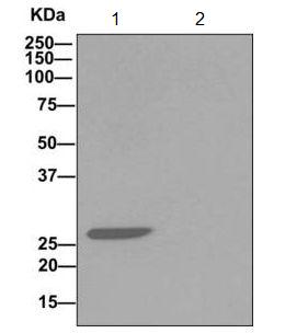 Immunoprecipitation - Anti-SDHB antibody [EPR13042(B)] (AB178423), expandable thumbnail