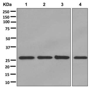 Western blot - Anti-SDHB antibody [EPR13042(B)] (AB178423), expandable thumbnail