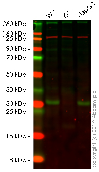 Western blot - Anti-SDHB antibody [EPR13042(B)] (AB178423), expandable thumbnail
