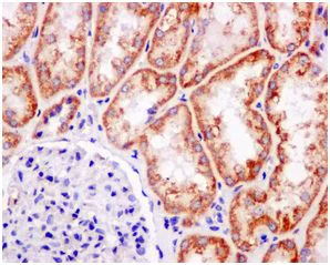 Immunohistochemistry (Formalin/PFA-fixed paraffin-embedded sections) - Anti-SDHB antibody [EPR13042(B)] - BSA and Azide free (AB250046)