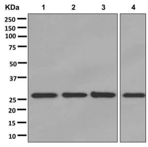 Western blot - Anti-SDHB antibody [EPR13042(B)] - BSA and Azide free (AB250046)