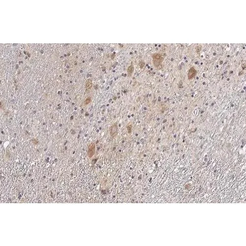 Immunohistochemistry (Formalin/PFA-fixed paraffin-embedded sections) - Anti-SDHB antibody [HL2251] (AB317178)