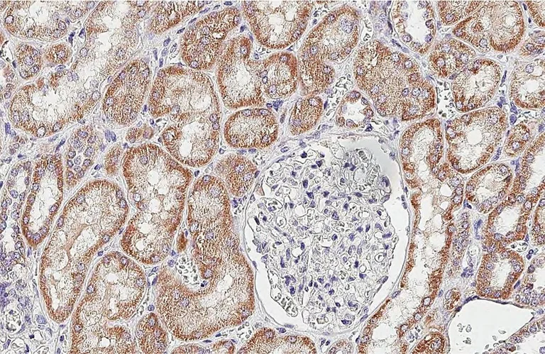 Immunohistochemistry (Formalin/PFA-fixed paraffin-embedded sections) - Anti-SDHB antibody [HL2251] (AB317178)