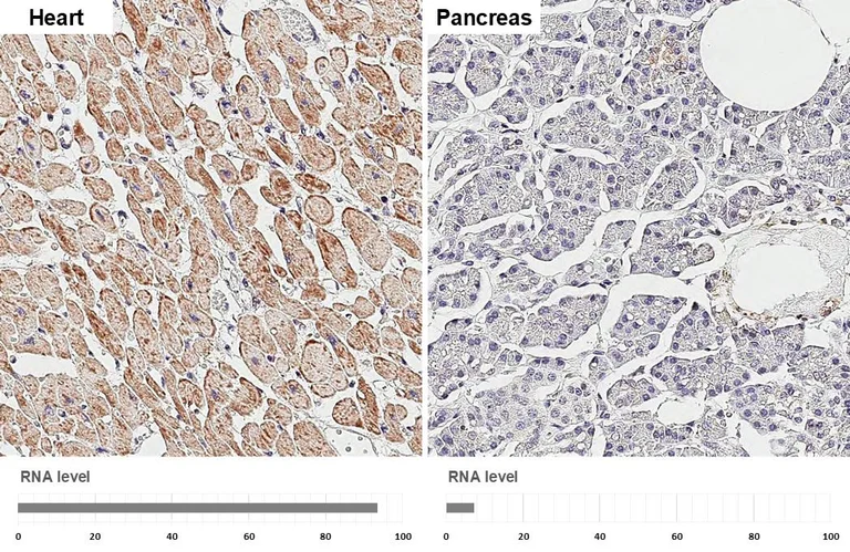 Immunohistochemistry (Formalin/PFA-fixed paraffin-embedded sections) - Anti-SDHB antibody [HL2251] (AB317178)