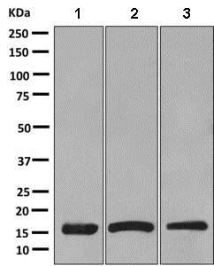 Western blot - Anti-SDHC antibody [EPR11035(B)] (AB155999)
