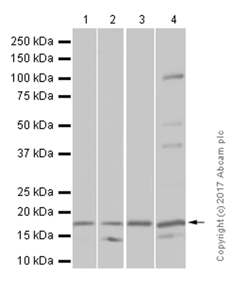Western blot - Anti-SDHC antibody [EPR11035(B)] (AB155999)