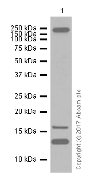 Western blot - Anti-SDHC antibody [EPR11035(B)] (AB155999)