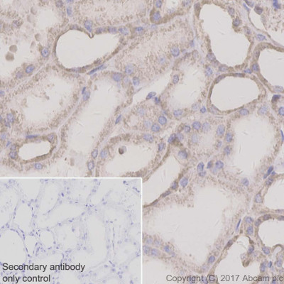 Immunohistochemistry (Formalin/PFA-fixed paraffin-embedded sections) - Anti-SDHC antibody [EPR11035(B)] - BSA and Azide free (AB240137), expandable thumbnail