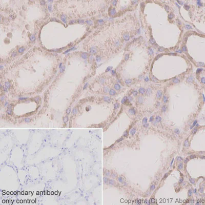 Immunohistochemistry (Formalin/PFA-fixed paraffin-embedded sections) - Anti-SDHC antibody [EPR11035(B)] - BSA and Azide free (AB240137)