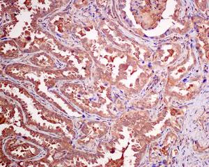 Immunohistochemistry (Formalin/PFA-fixed paraffin-embedded sections) - Anti-SDHC antibody [EPR11035(B)] - BSA and Azide free (AB240137)
